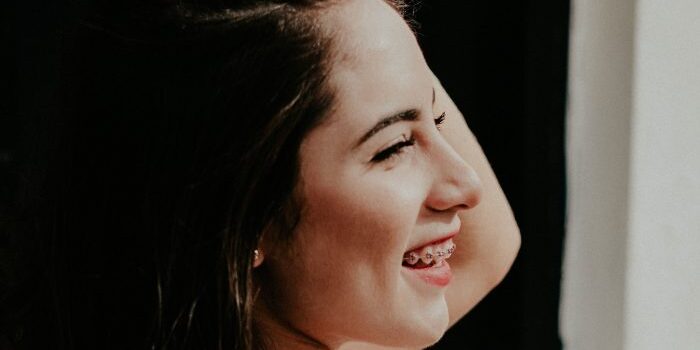 ortodonti-yazısı-fotosu-kucuk-700×400