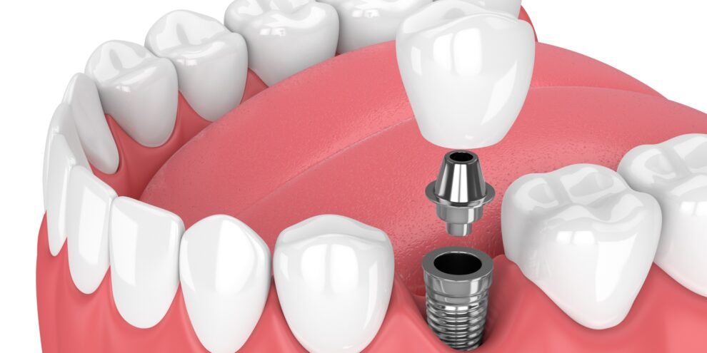 shutterstock-1043643103-d4e15c2b-e4d1-4870-bdd1-68ae3a215a3a